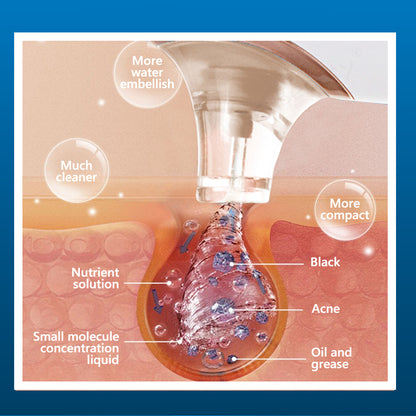 First Generation “Small Bubble” Skin Treatment Machine