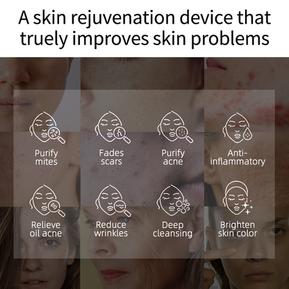 Plasma Skin Resurfacing Beauty Device