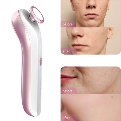 Plasma Skin Resurfacing Beauty Device
