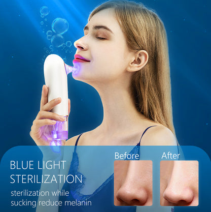 First Generation “Small Bubble” Skin Treatment Machine