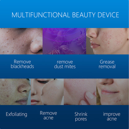 First Generation “Small Bubble” Skin Treatment Machine