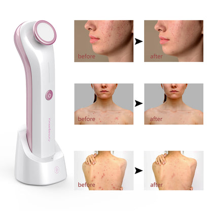 Plasma Skin Resurfacing Beauty Device