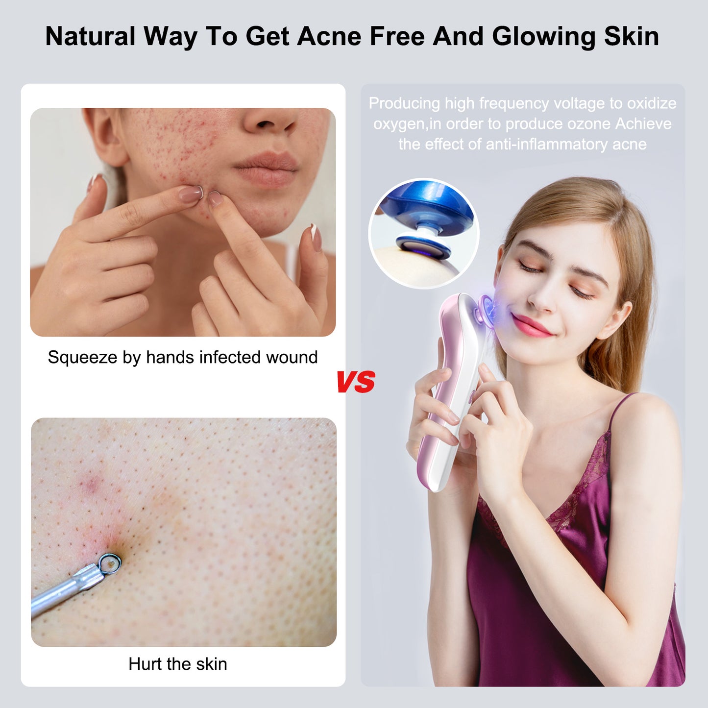 Plasma Skin Resurfacing Beauty Device